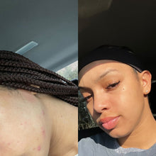 Load image into Gallery viewer, Turmeric & Vitamin C Bar